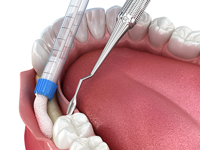 Great Marsh Dental | Ceramic Crowns, Periodontal Treatment and Emergency Treatment