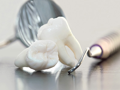 Great Marsh Dental | Teeth Whitening, Sports Mouthguards and Dental Cleanings