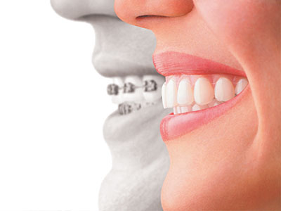 Great Marsh Dental | Ceramic Crowns, Laser Dentistry and Sedation Dentistry