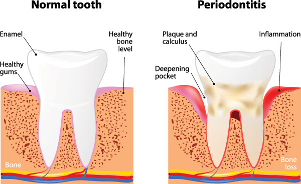 Great Marsh Dental | Oral Exams, Periodontal Treatment and Dental Fillings