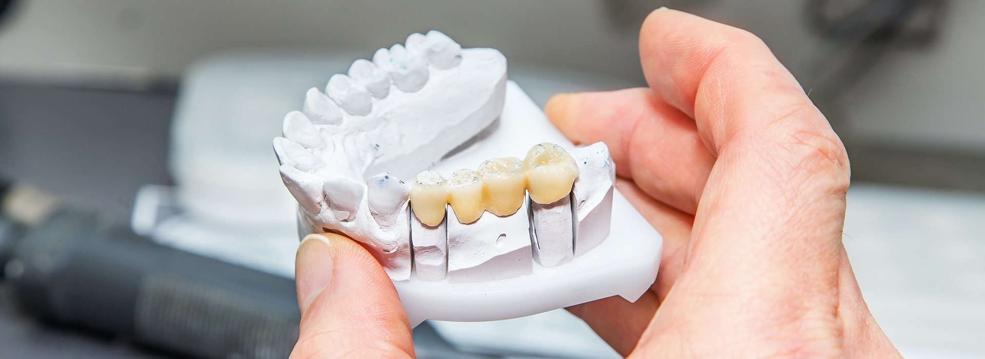 Great Marsh Dental | Implant Dentistry, Periodontal Treatment and Teeth Whitening