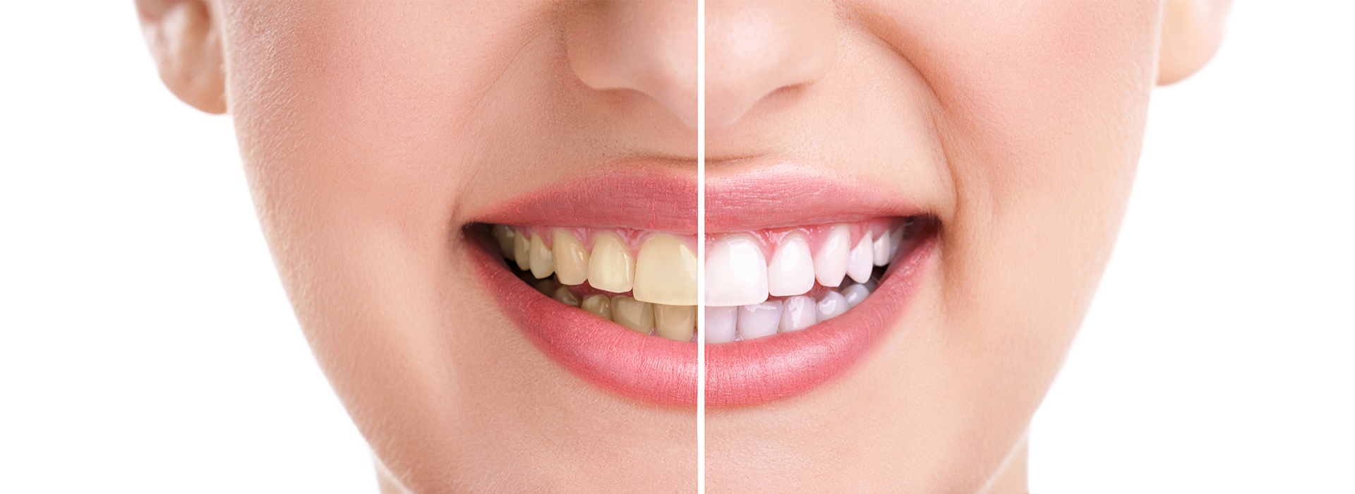 Great Marsh Dental | Dentures, Periodontal Treatment and Ceramic Crowns